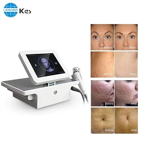 Rf Microneedle Rf Microneedling Machine Salon Utilizare fracțională portabilă Rf Face Lifting Microneedle Equipo