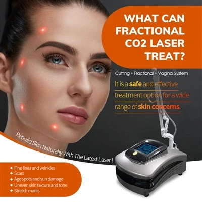 Cea mai nouă Mașină cu laser CO2 Reapariția pielii